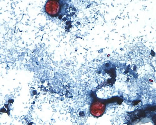 The Cyclospora Surge Is a Warning: America’s Food-Safety Puzzle Is Missing Pieces