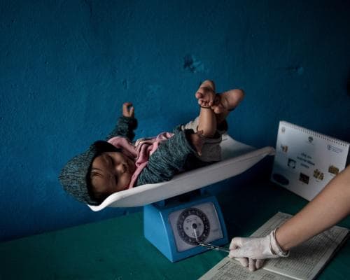 Nepal’s Malnutrition Crisis Exposes the Cost of Broken Global Health Supply Chains